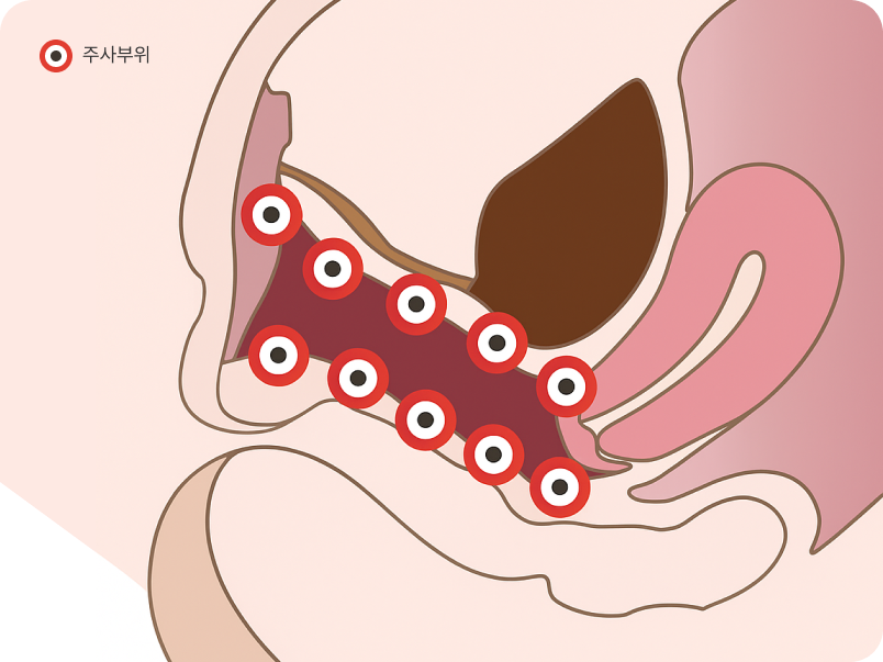 CGP 줄기세포 여성 성의학