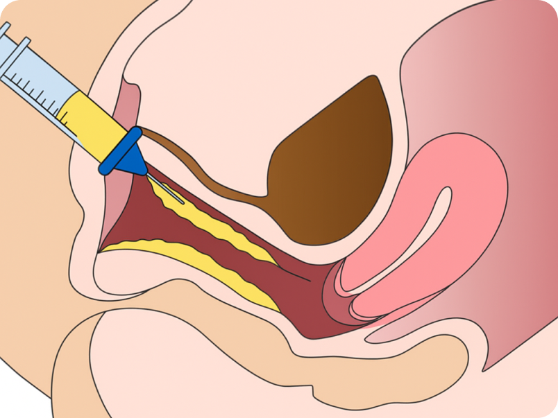 CGP 줄기세포 여성 성의학