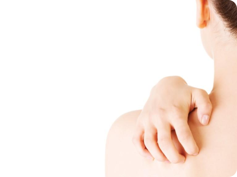 CGP 줄기세포 피부재생 (문제성 피부)